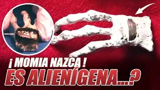 REVELAN IMPLANTE DE METAL ALIEN EN LA MANO DE UNA MOMIA DE PERÚ | Archivos de Divulgación