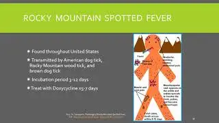 Ticks video