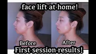 AOGNY RF beauty Instrument try on! RF at home. Anti aging face lifting device