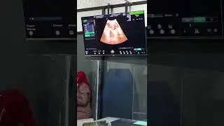 PERIKSA KANDUNGAN DI DR.DJAMIL