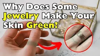Why Does Some Jewelry Make Your Skin Green?