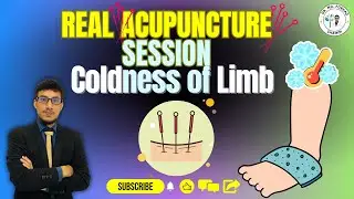 Acupuncture REAL SESSION | Acupuncture Relieving Cold Limbs | What to Expect | How to?