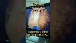 Савол 