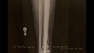 No Time for Caution - The Days Are Long, But The Years Are Short [Album] (2023)