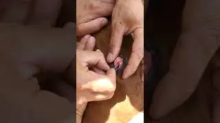 Удаление катаракты