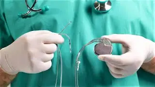 Главный аритмолог Югры расскажет, как  настраивают и чинят кардиостимуляторы