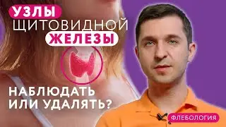 Как лечить узлы щитовидной железы? // 