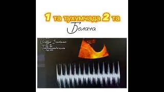 МАЛУМОТ УЧУН ФАКАТ ТЕЛЕГРАМДАН ЁЗИНГ: +998950014004 #Узи #беременность #гинекология #Хомиладорлик