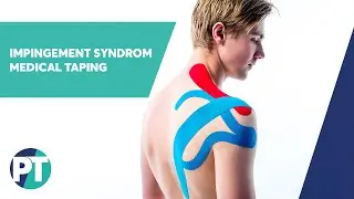 Impingement-Syndrom | Medical Taping | PhysioTape