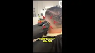 what is a bald fade?