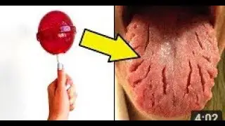 6 САМЫХ ОПАСНЫХ СЛАДОСТЕЙ  НЕ ЕШЬТЕ ЭТО!