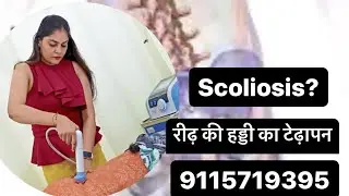 Scoliosis?स्कॉलियोसिस या रीढ़े की हड्डी का टेढ़ापन? #backpain #chiropractic #rajpur #chiropractor