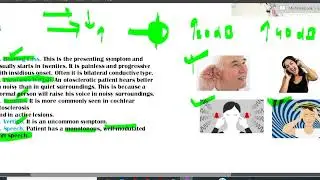 otosclerosis