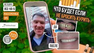 ЧТО ПРОИСХОДИТ если НЕ БРОСАЕШЬ КУРИТЬ? - имплантация зубов видеоотзыв в Дантистофф