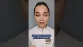 В каком возрасте можно начинать делать БОТУЛИНОТЕРАПИЮ? 
