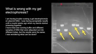 How to interpret Plasmid DNA Gel Electrophoresis results