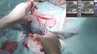шунт у собаки