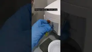 serum creatinine testing 