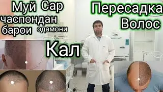 Муй Сар часпондан барои, Одамони Кал Пересадка Волос.