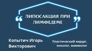 Липосакция при лимфедеме