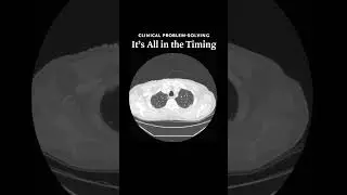 It’s All in the Timing (Video 1) | NEJM