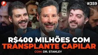 QUANTO CUSTA UM TRANSPLANTE CAPILAR? VALE A PENA? (COM STANLEY’S HAIR) | PrimoCast 359
