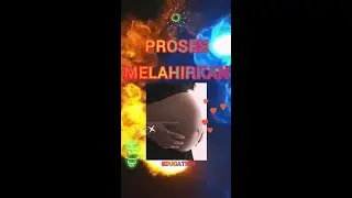 Proses Melahirkan Bayi Secara Normal