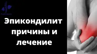 ЭПИКОНДИЛИТ ЛОКТЕВОГО СУСТАВА - Причина и Лечение
