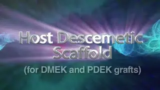Host Descemetic Scaffolding for PDEK DMEK  Soosan Jacob