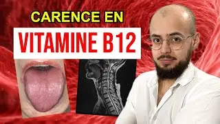 CARENCE en VITAMINE B12 : Les causes et conséquences.