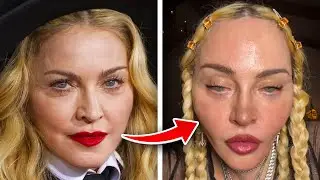 What Happened to Madonna's Face?