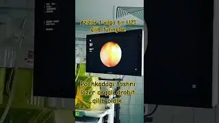 Videoni yaqiningizga junatib quying. 