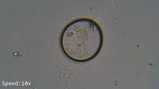 Pond Water Observation 12.04.2024 - Decaying Paramecium on dry slide