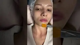 ТРЕШ КОСМЕТОЛОГ💉😱