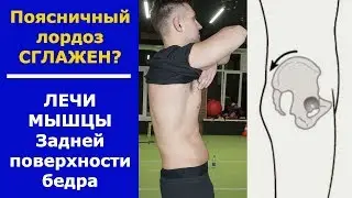 Почему поясничный лордоз выпрямлен. Как его восстановить?