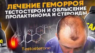 Лечение геморроя. Тестостерон и облысение. Пролактинома и стероиды. Анализы во время курса.
