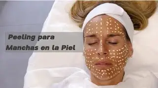 Peeling para Manchas en la Piel