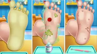ASMR | Animasi Perawatan Kaki Bau
