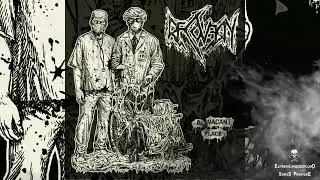 ➤ RECOVERY - Fake Surgery-☠(𝐓𝐑𝐀𝐂𝐊 𝐏𝐑𝐄𝐌𝐈𝐄𝐑𝐄 𝟐𝟎𝟐𝟯)☠