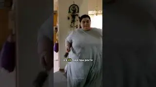 От самой толстой женщины на земле до Супермодели😲 