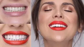 BEST AT HOME TEETH WHITENING | ALI ANDREEA