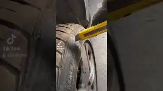 Удаление грыжи😂