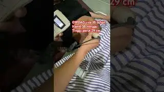 Hamil 18 tahun pembukaan 10 tinggi perut 29 cm