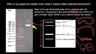 Plasmid Gel Electrophoresis