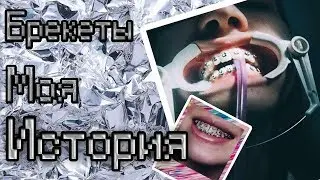 БРЕКЕТЫ | МОЯ ИСТОРИЯ