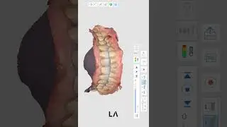Record mandibular movement with medit i500 