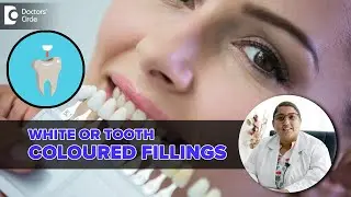 Composite Dental Filling | Tooth Colored/White Fillings - Dr.Karthika Krishna Kumar| Doctors Circle