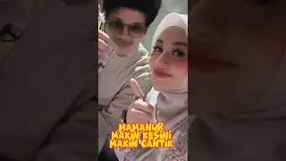AUREL MAMANUR MAKIN KESINI MAKIN CANTIK 