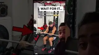Doctor reacts to WORST gym injury ever! 