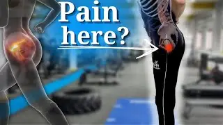 5 BEST Rehab Exercises For GTPS (Greater Trochanteric Pain Syndrome)!